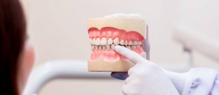 Benefits of Dental Implants for Seniors